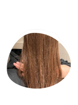 Best Skin & Hair Specialist in Gwalior