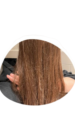 Best Skin & Hair Specialist in Gwalior