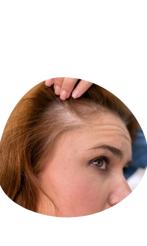 Best Skin & Hair Specialist in Gwalior