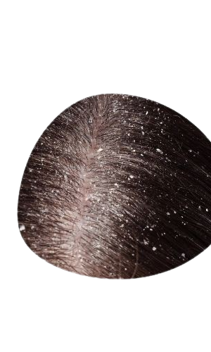 Best Skin & Hair Specialist in Gwalior