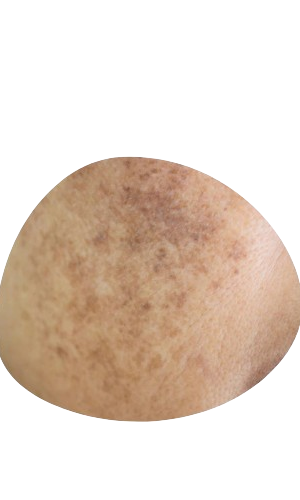 Best Skin & Hair Specialist in Gwalior